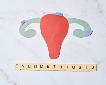Endometriosis