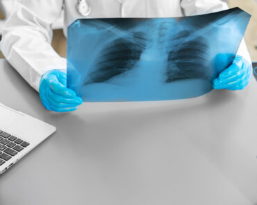 EPOC: La enfermedad pulmonar silenciosa que puedes  ...