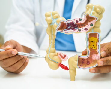 Cáncer de Colon: ¿Cuándo es necesario hacerse un ...